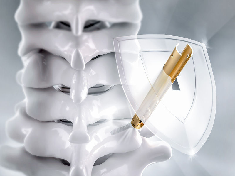 Ennovate® Cervical MIS – Minimal intervention. Enhanced protection.