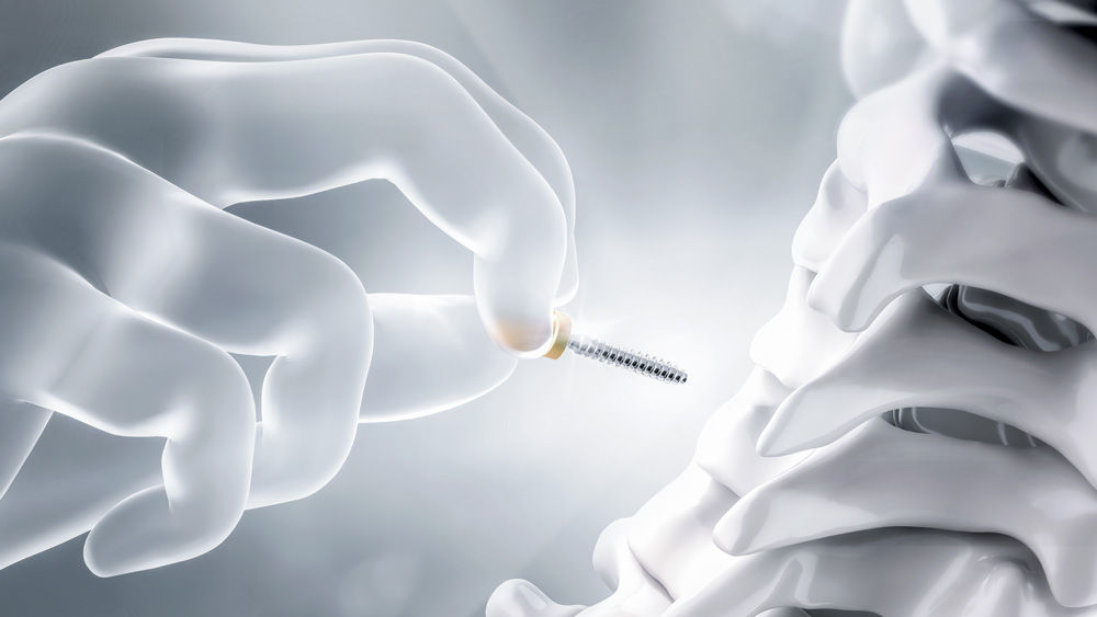 Ennovate® Cervical EnnoTip