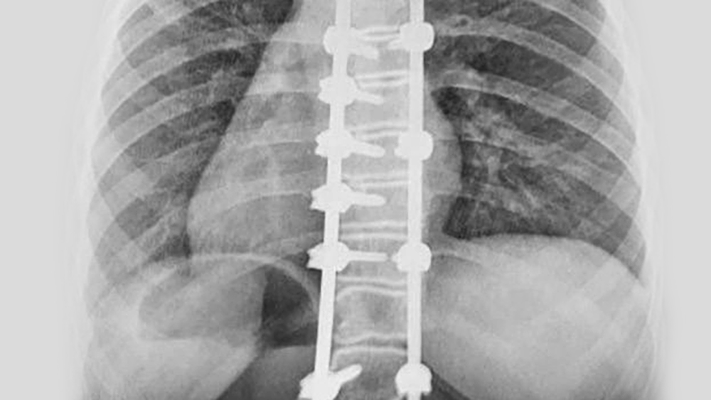 X-ray image
